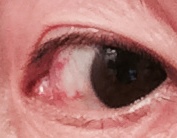 eye子の目